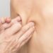 Physiotherapie